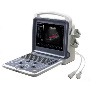 Ultrasonido doppler color: Sistema de imágenes de alta resolución Diseño ergonómico de fácil operación y mejor optimización recepción de Compra en Guantes.